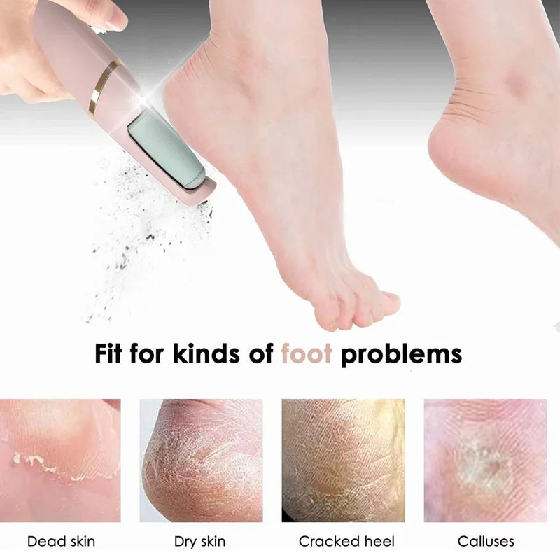 Rechargeable Electric Callus Remover for Smooth, Soft Feet