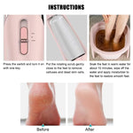 Rechargeable Electric Callus Remover for Smooth, Soft Feet